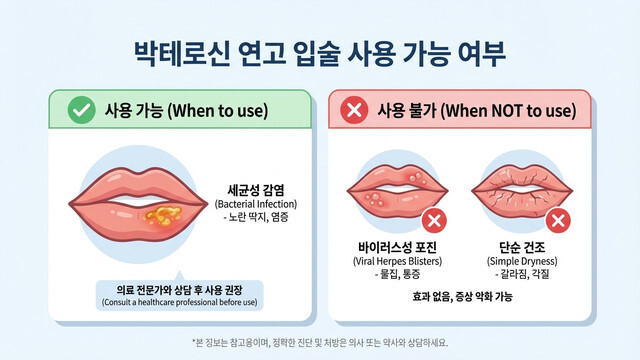 박테로신 연고 입술에 발라도 될까? 구각염과 물집 치료 시 주의점 총정리