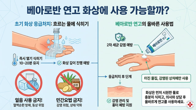 베아로반 연고 화상에 무심코 바르면 안 되는 이유와 올바른 응급처치법